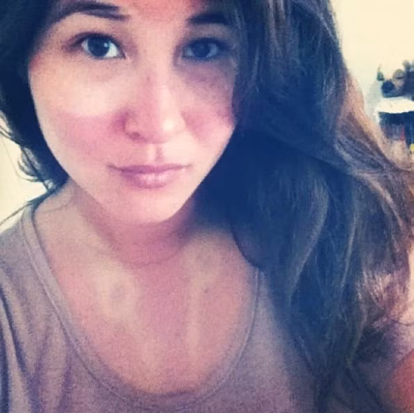 Những thảm cảnh cháy nắng mùa hè khiến bạn không thể yêu thêm những ngày nắng nóng - Ảnh 9.