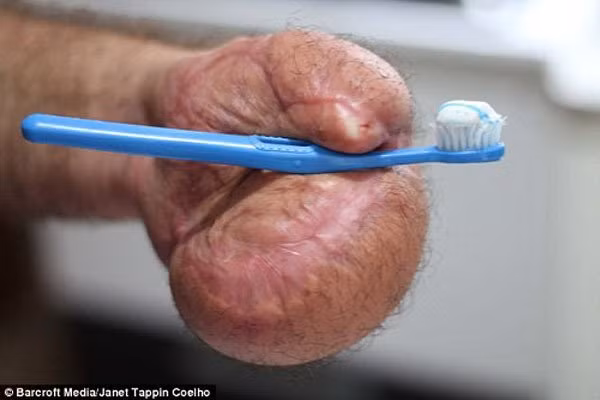 Bác sĩ khâu tay người đàn ông vào dạ dày và cái kết bất ngờ