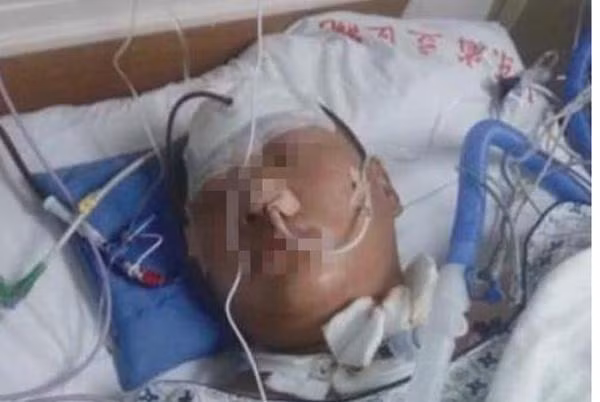 Bé 6 tuổi vừa thức dậy bỗng đột quỵ, cha mẹ nên lưu ý bộ phận này của trẻ ảnh 1 be trai 6 tuoi vua thuc day bong dot quy, cha me nen luu y bo phan nay cua tre - 1