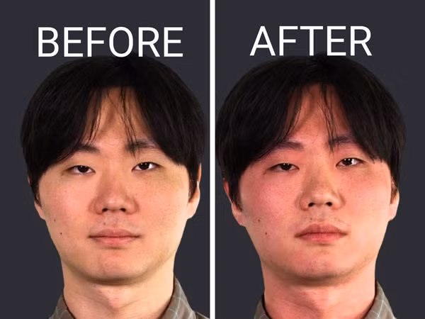 4 dấu hiệu sau khi uống rượu chứng tỏ gan đang tổn thương nghiêm trọng-1