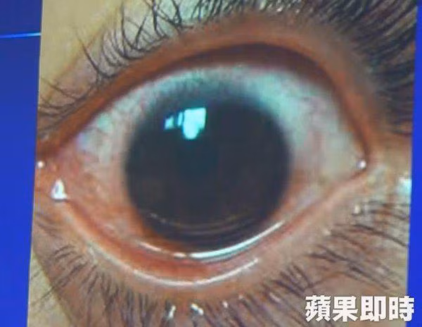 co gai thung hon 500 lo trong mat vi mot sai lam khi dung dien thoai khong it nguoi mac - 3