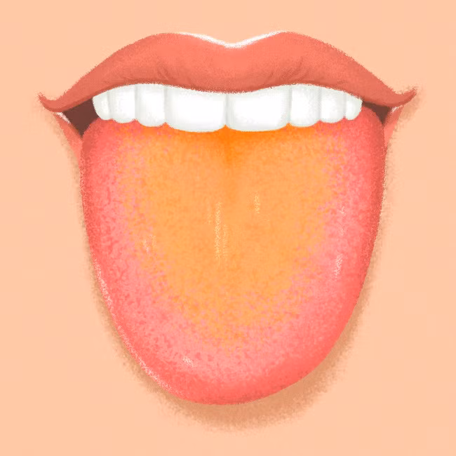 9 dấu hiệu xuất hiện trên lưỡi cảnh báo sức khỏe nguy hiểm ảnh 7