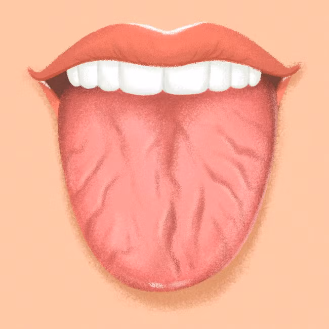 9 dấu hiệu xuất hiện trên lưỡi cảnh báo sức khỏe nguy hiểm ảnh 4