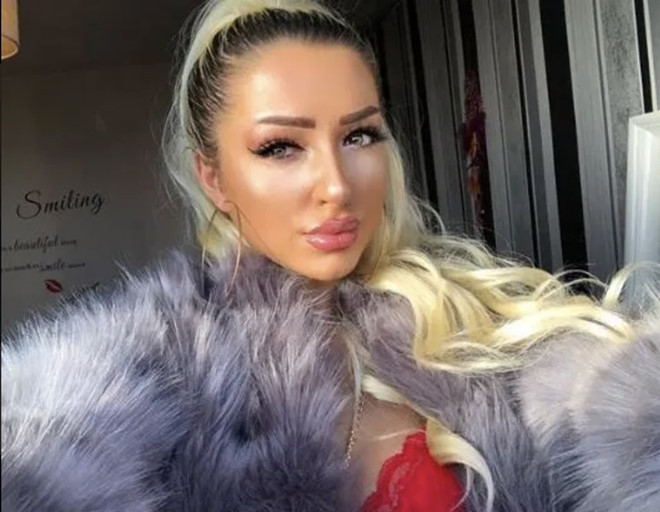 Hot girl tiêm filler để có gương mặt con nhà giàu như Kylie Jenner ảnh 6 Hot girl tiem filler de co guong mat con nha giau nhu Kylie Jenner hinh anh 6