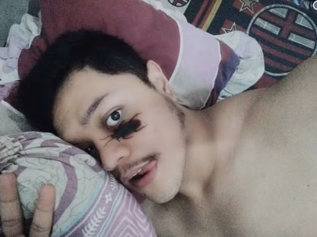 Kinh dị trào lưu chụp ảnh tự sướng với gián trên mặt