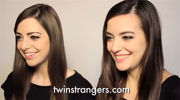 Hiện tượng song trùng hàm chứa nhiều bí ẩn ảnh 7