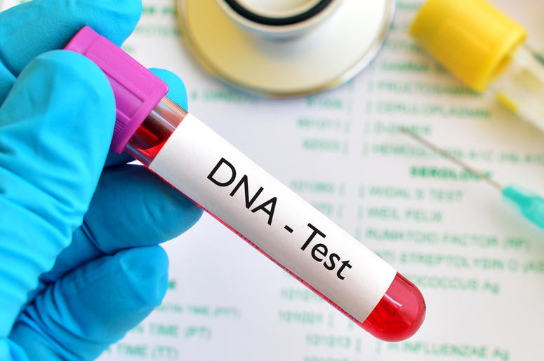 Xét nghiệm DNA tìm bố đẻ, người đàn ông không tin nổi khi nhận kết quả hình ảnh 3 xet nghiem dna tim bo de, nguoi dan ong khong tin noi khi nhan ket qua hinh anh 3
