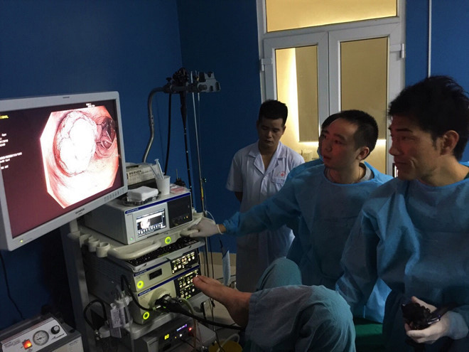 Nội soi phát hiện sớm ung thư đại trực tràng /// Ảnh: Nam Sơn