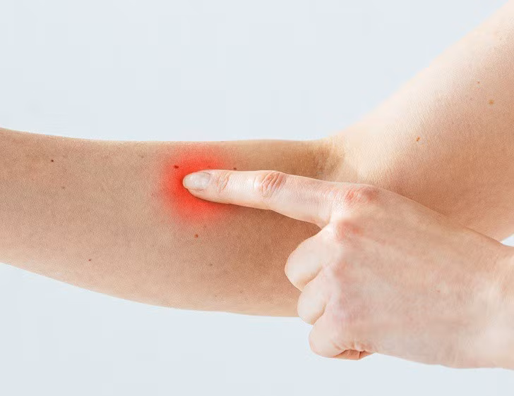 13282810-image-crop-1193x922-1559301570-728-f4ad7c2931-1560500239