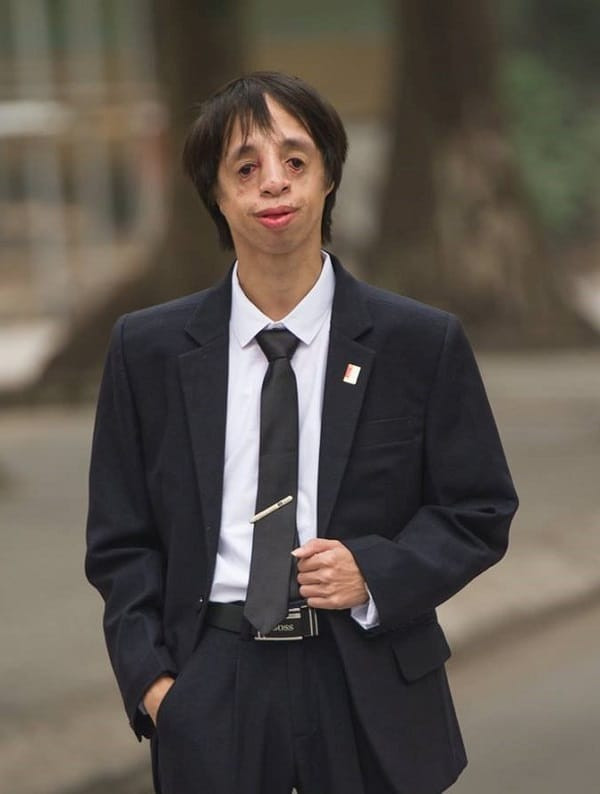 Anh chàng cựu sinh viên giỏi đặc biệt của đại học Bách Khoa: Không có tai, gương mặt đặc biệt nhưng nghị lực phi thường