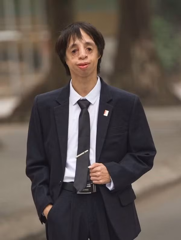 Anh chàng cựu sinh viên giỏi đặc biệt của đại học Bách Khoa: Không có tai, gương mặt đặc biệt nhưng nghị lực phi thường