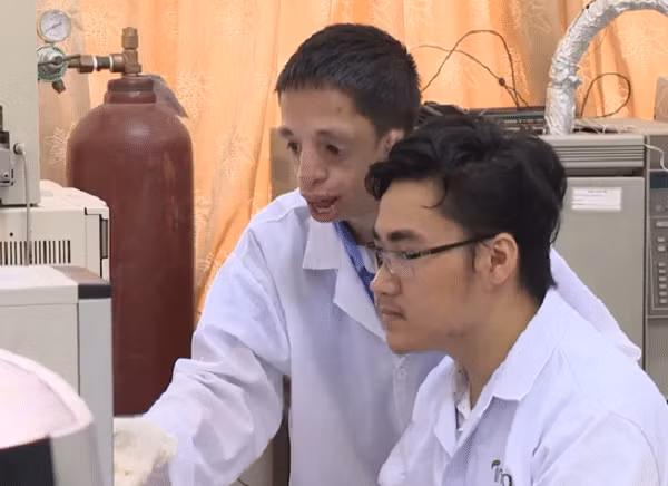 Anh chàng cựu sinh viên giỏi đặc biệt của đại học Bách Khoa: Không có tai, gương mặt đặc biệt nhưng nghị lực phi thường