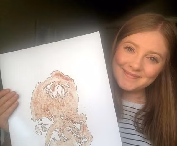 Nữ hộ sinh kiếm thêm 250 triệu đồng/năm nhờ việc làm không ngờ