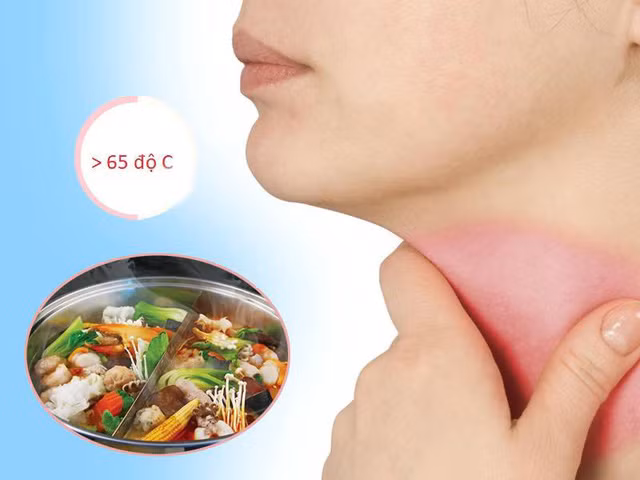 7 sai lầm khi ăn món lẩu được dễ rước về cả tá bệnh tật ảnh 3