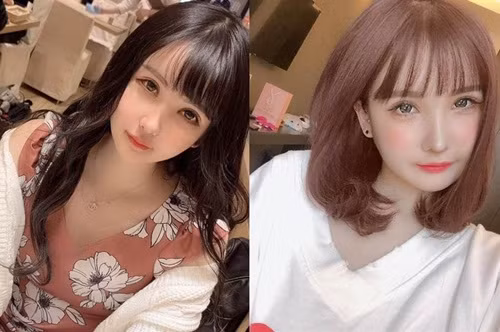 co gai quyet phau thuat tham my chi vi mot cau noi cua bo hinh anh 2