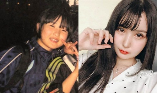 co gai quyet phau thuat tham my chi vi mot cau noi cua bo hinh anh 1