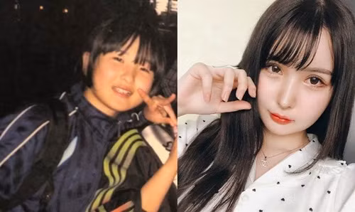 Cô gái quyết phẫu thuật thẩm mỹ vì một câu nói của bố