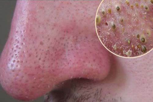 Luộc trứng gà, lăn qua lăn lại trên mặt và chờ xem điều bất ngờ xảy ra ảnh 6 luoc trung ga len, lan qua lan lai tren mat va cho xem dieu bat ngo gi xay ra - 6