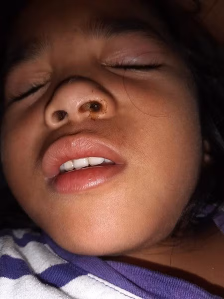 Bé Scarlett Chavez vừa lâm vào tình cảnh hết sức đáng quan ngại