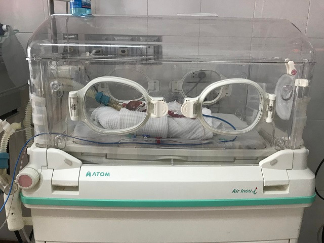 Bé được nuôi trong lồng ấp. Ảnh: V.H