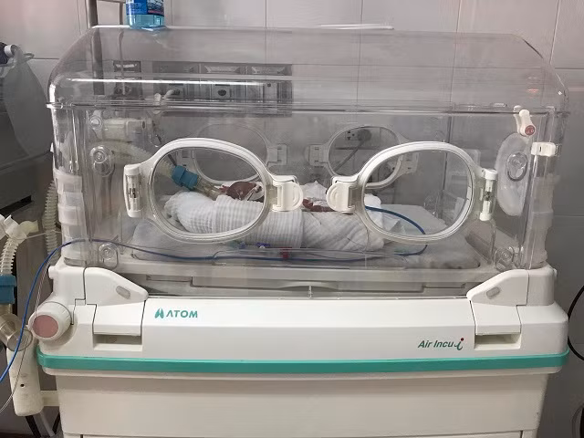 Bé được nuôi trong lồng ấp. Ảnh: V.H