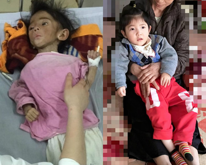 Em bé Lào Cai gầy gò, ốm yếu ngày nào giờ thay da đổi thịt nhờ sự chăm sóc của mẹ nuôi. 9X nhan nuoi be bai nao o Lao Cai: Nhin con rot nuoc mat khong nhan ra hinh anh 1