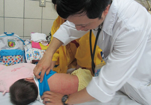 Một bệnh nhi mắc sởi đang điều trị tại khoa Nhi, Bệnh viện Bạch Mai. Ảnh:N.Phương. soi10-1524-1396943198.jpg