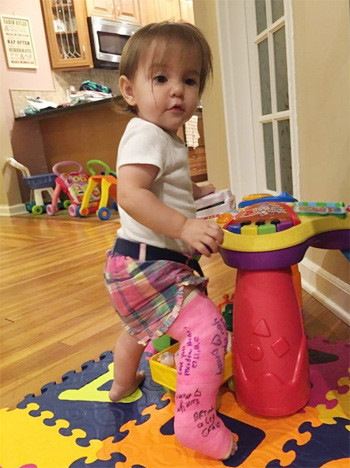 Em bé phải bó bột sau khi trượt cùng mẹ. Ảnh: Metro.