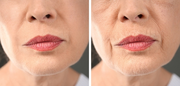 Ở độ tuổi 30, bạn có thể dễ dàng nhận ra dấu hiệu lão hóa trên da.