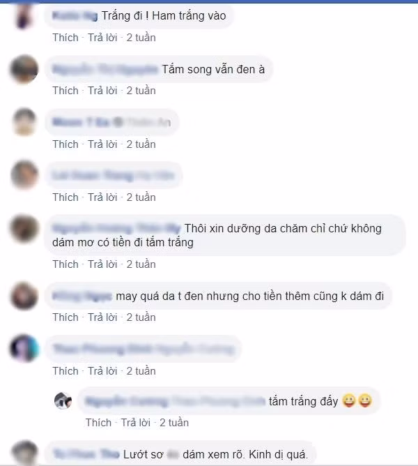 Lạm dụng tắm trắng khiến da bị bào mòn, cô gái hoảng hốt khi mạch máu nổi rõ mồn một đáng sợ