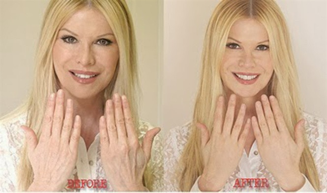 14-28-29_cindy-jckson-plstic-surgery-before-fter