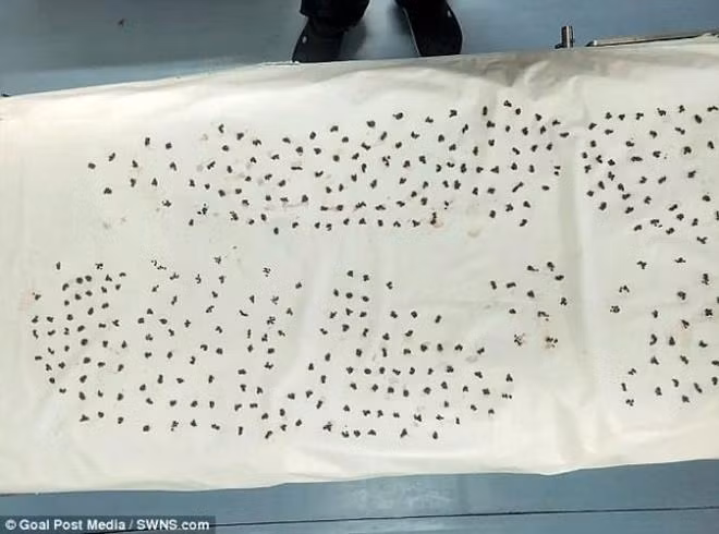 Đau bụng nhập viện, người đàn ông khiến bác sĩ kinh hãi khi thấy thứ trong cơ thể - 3