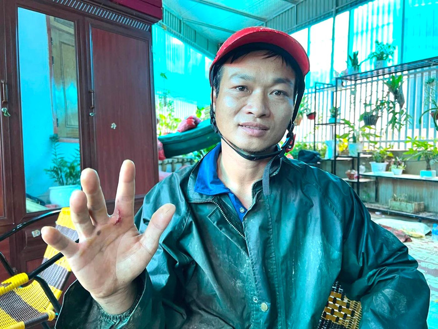 Anh Vi Văn Truyền bị thương ở tay trong quá trình cứu người ra khỏi lũ dữ. Ảnh: Quốc Huy Anh Vi Văn Truyền bị thương ở tay trong quá trình cứu người ra khỏi lũ dữ. Ảnh: Quốc Huy