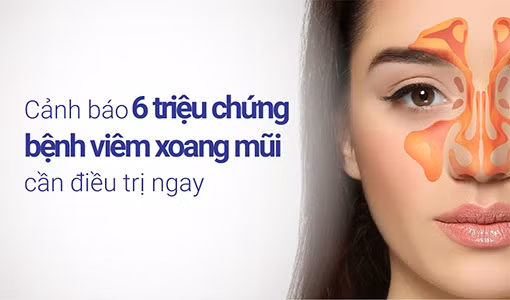 Nhận biết triệu chứng bệnh viêm xoang mũi giúp điều trị chính xác.