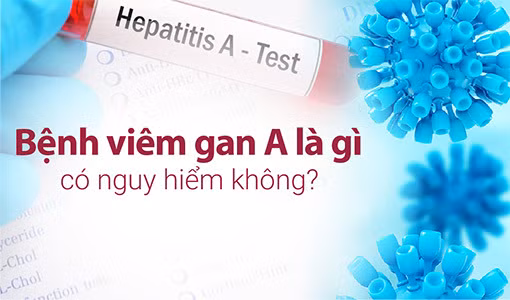 Bệnh viêm gan A là bệnh có thể hồi phục hoàn toàn. 