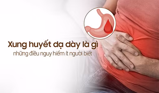 Tìm hiểu xung huyết dạ dày là gì và cách khắc phục