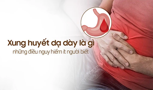 Tìm hiểu xung huyết dạ dày là gì và cách khắc phục