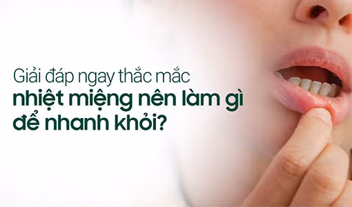 Nhiệt miệng gây nhiều đau đớn khó chịu.