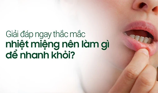 Nhiệt miệng gây nhiều đau đớn khó chịu.