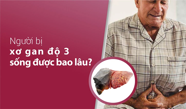 Người bị xơ gan độ 3 sống được bao lâu?