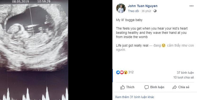 Đây được xem là lời xác nhận chân dài đã mang thai con đầu long sau 7 tháng kết hôn.