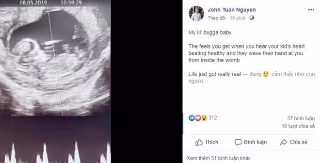 Đây được xem là lời xác nhận chân dài đã mang thai con đầu long sau 7 tháng kết hôn.