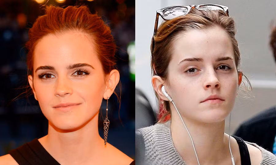 Nằm trong top những ngôi sao có gương mặt đẹp nhất thế giới, Emma Watson luôn tự tin ngay cả khi để mặt mộc ra phố. Người đẹp sở hữu khuôn mặt nhỏ nhắn cùng đôi mắt hút hồn người đối diện. Thậm chí những đốm tàn nhang khi không son phấn lại làm cô trở nên ngây thơ và đáng yêu hơn.