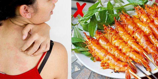 Người phụ nữ bất tỉnh sau khi ăn tôm càng, bộ phận này của tôm vạn lần nên tránh xa-3