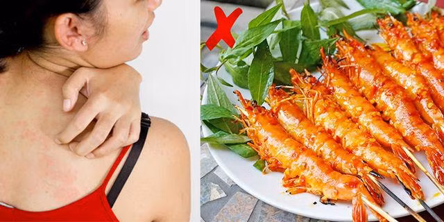 Người phụ nữ bất tỉnh sau khi ăn tôm càng, bộ phận này của tôm vạn lần nên tránh xa-3