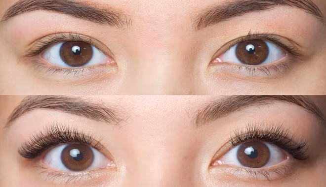 660x380_1thumb-20170510053239