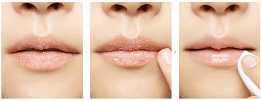 6-cach-tay-te-bao-chet-cho-moi-cuc-ki-don-gian-va-hieu-qua-thuc-hien-tai-nha-8