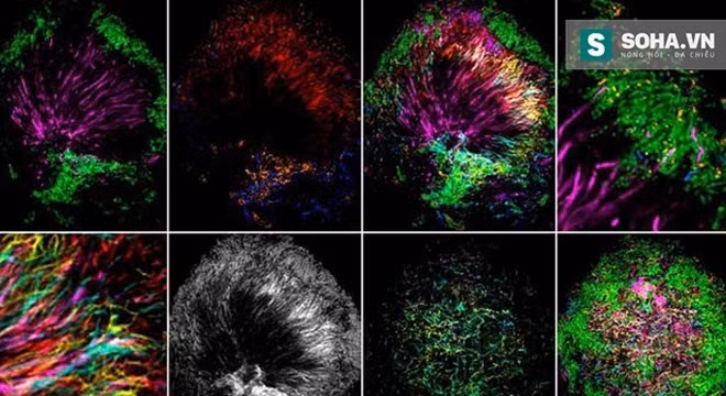 Mê mẩn với những hình ảnh vi khuẩn trong miệng đẹp mê hồn