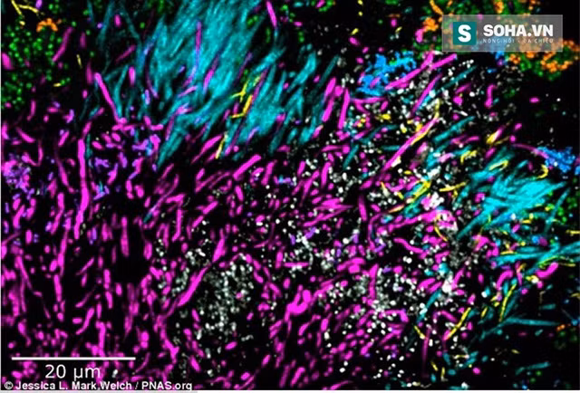 Mê mẩn với những hình ảnh vi khuẩn trong miệng đẹp mê hồn ảnh 9