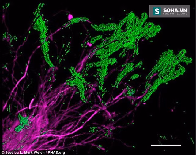  Những hình ảnh nhiều nhất là vi khuẩn bạch hầu (Corynebacterium). 